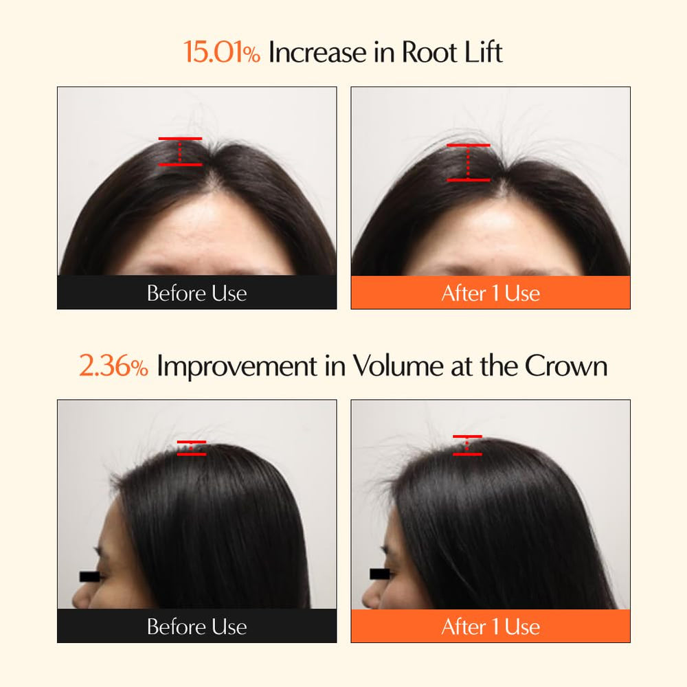 Lilyeve GrowTurn scalp massage action showing gentle exfoliation and oil balance