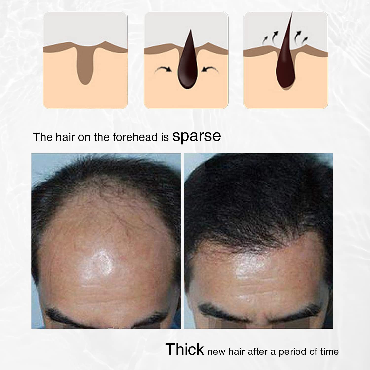 LINEDSON black seed oil detail for conditioning scalp.