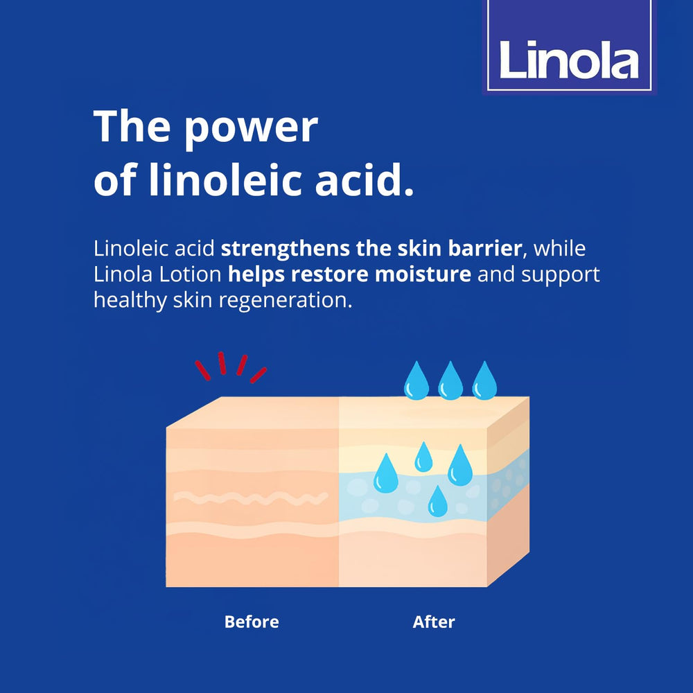 Linola Lotion vegan packaging highlights dermatologist-tested safety