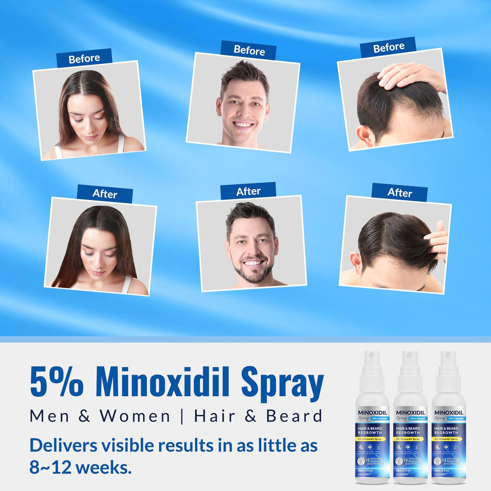 Listarfe man applying Minoxidil for beard and hair support