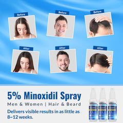 Listarfe man applying Minoxidil for beard and hair support