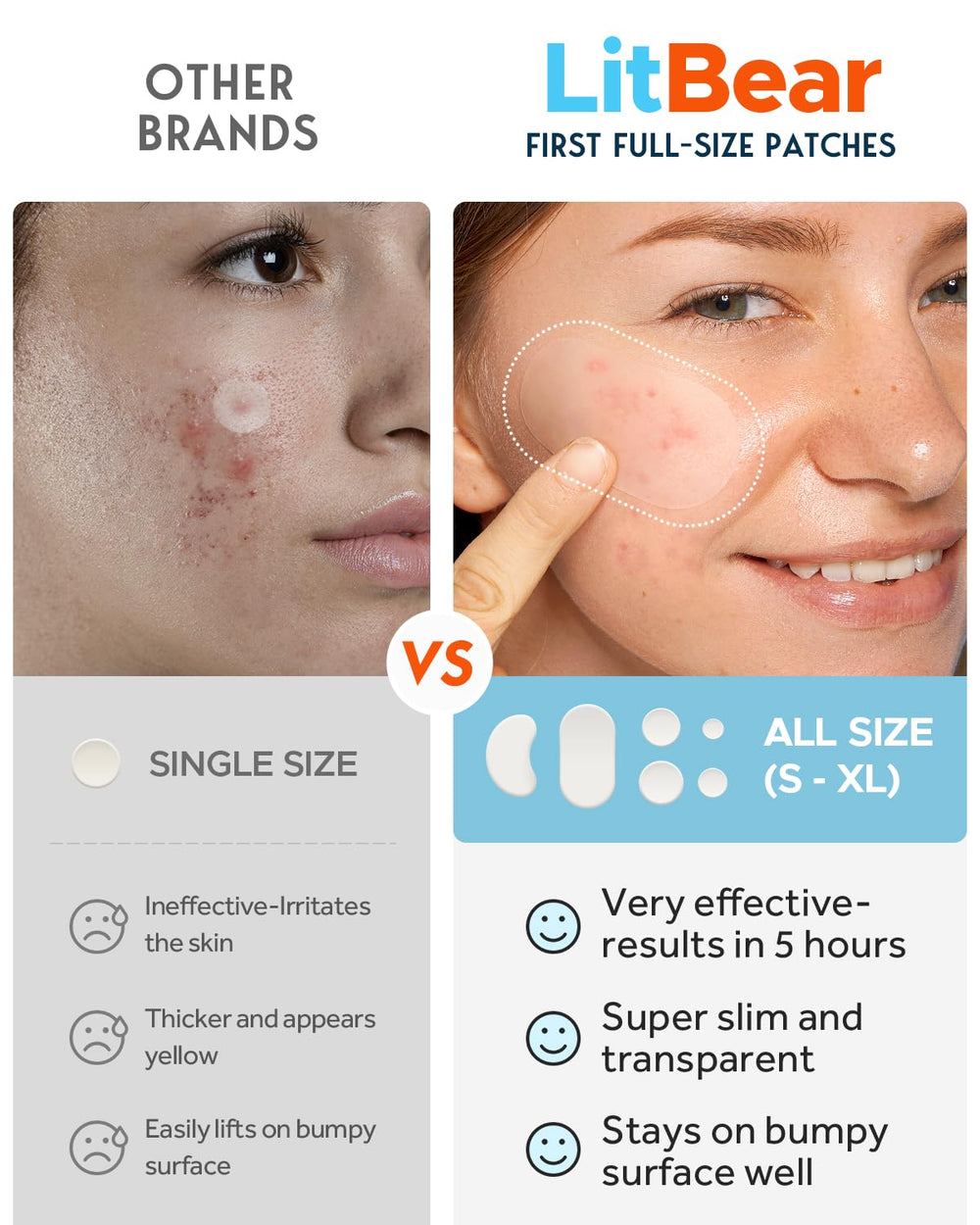 LitBear 14mm acne patch on a bigger breakout for full-coverage care