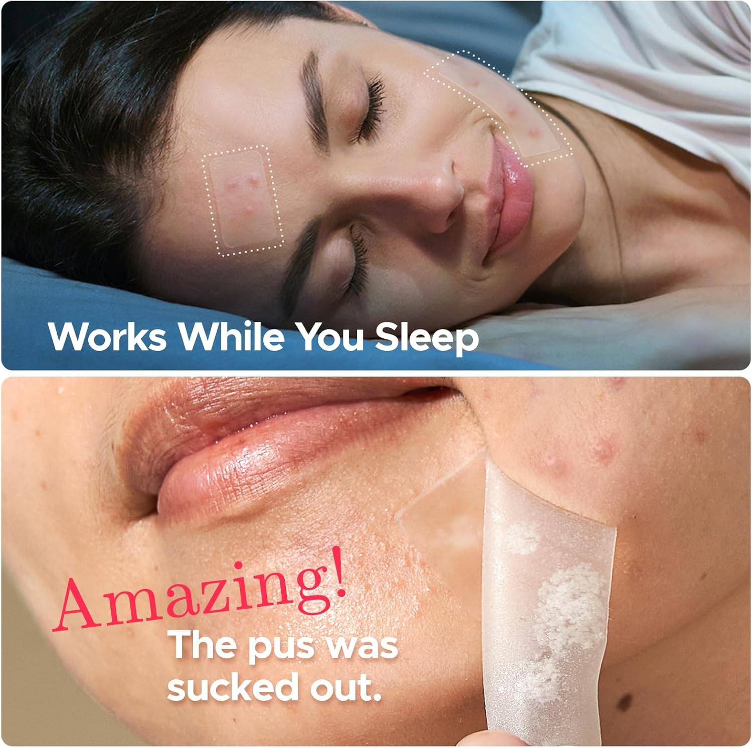 LitBear 26x38mm zit patch targets bigger spots with coverage