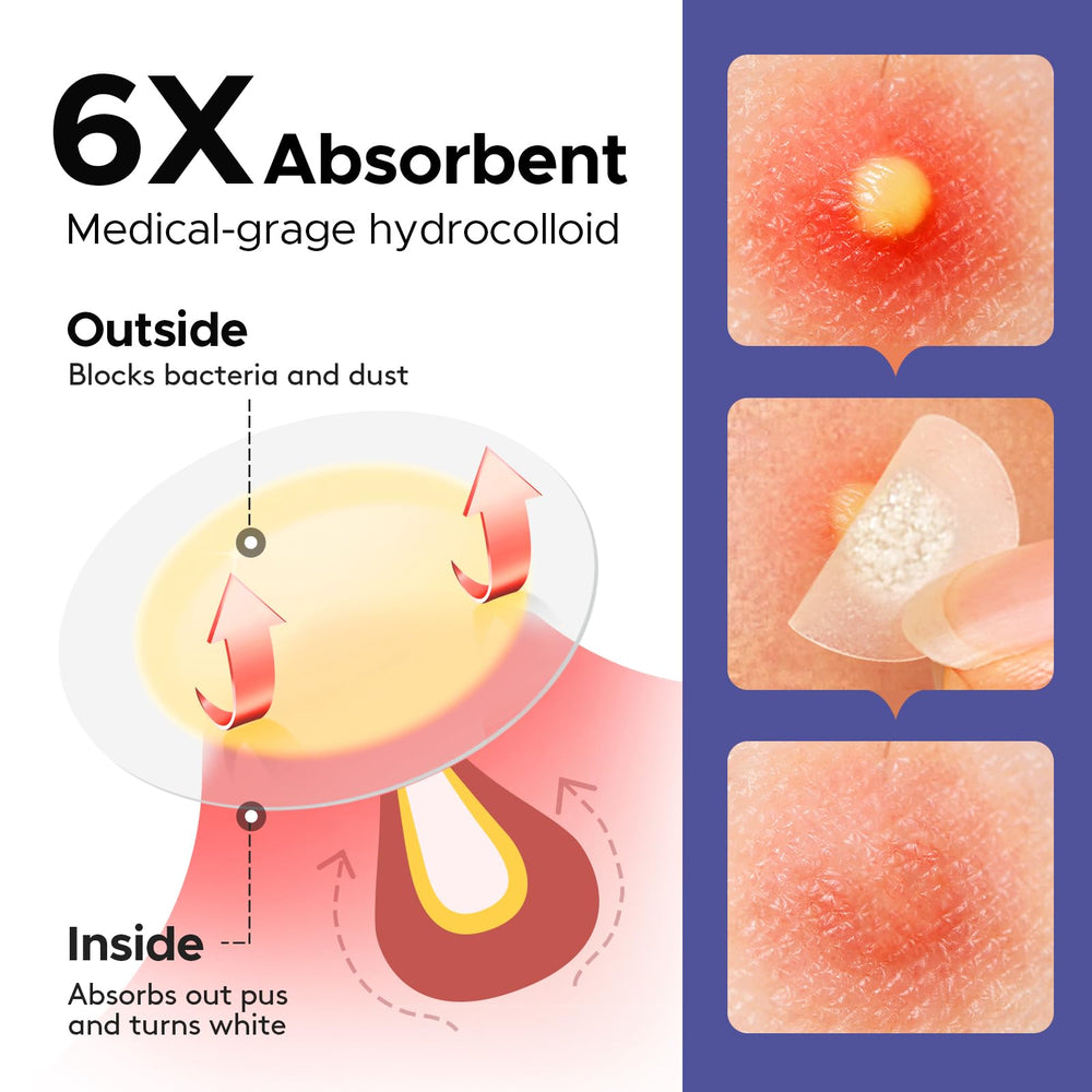 LitBear four-size patch kit offers versatile coverage options.