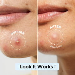 LitBear patch in 8mm, 10mm, and 12mm sizes for pimples