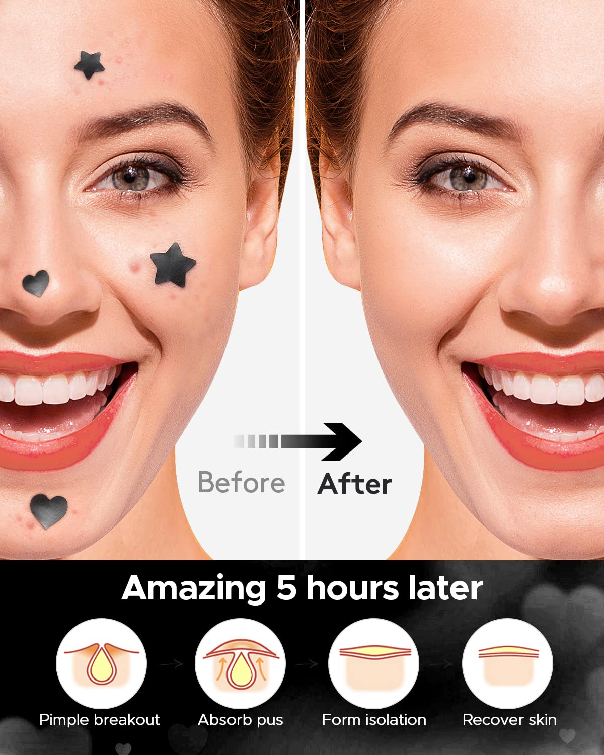 LitBear patch-on-face application for quick, easy blemish care.
