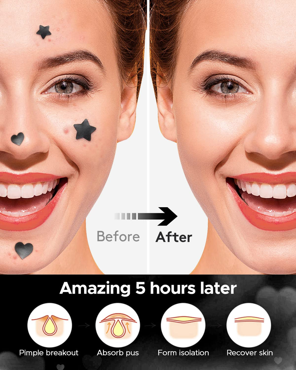 LitBear patch-on-face application for quick, easy blemish care.