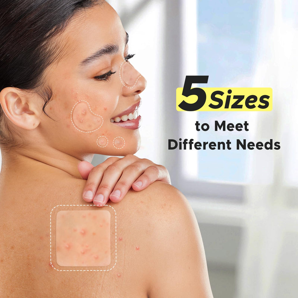 LitBear patches on the chest target pimples during daily activities.