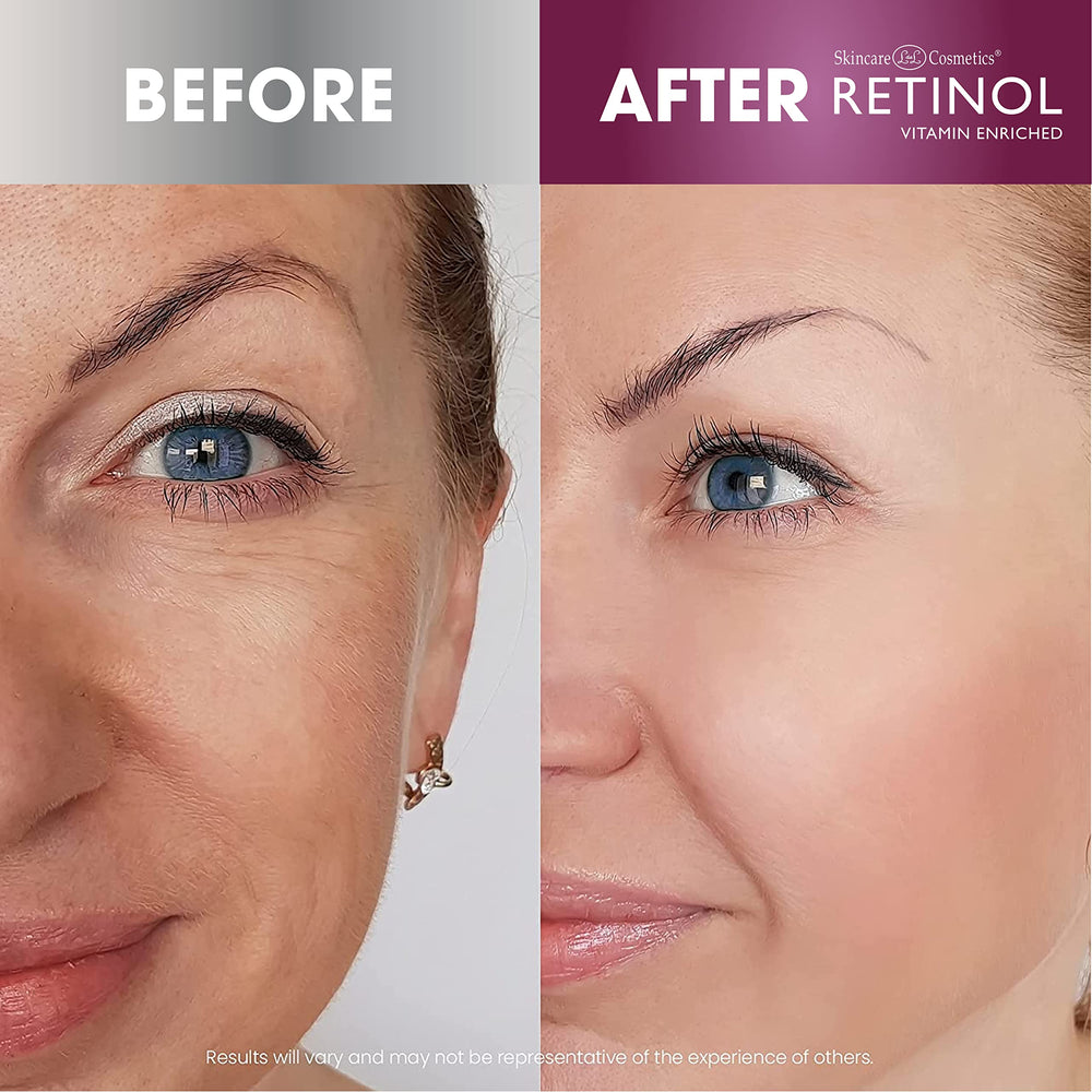 LIVAURA rich creamy texture demonstrates non-greasy, hydrating feel.