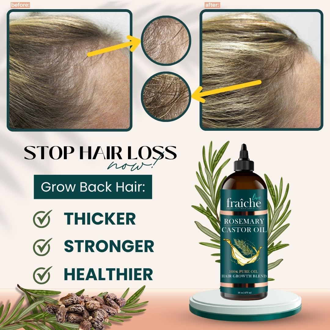 Live Fraiche precision cap bottle enables mess-free scalp application.