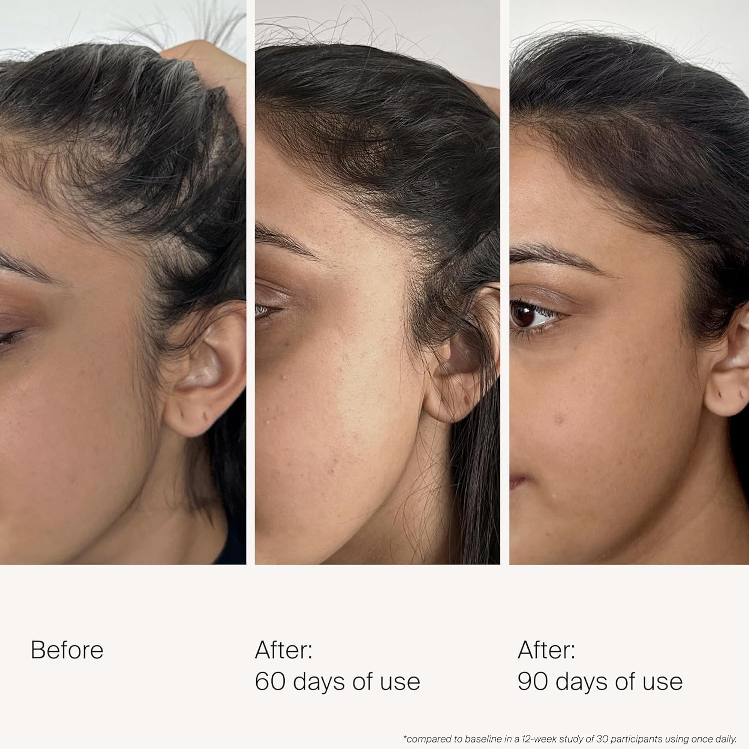 Living Proof Density Serum drop dispenser for precise scalp application.