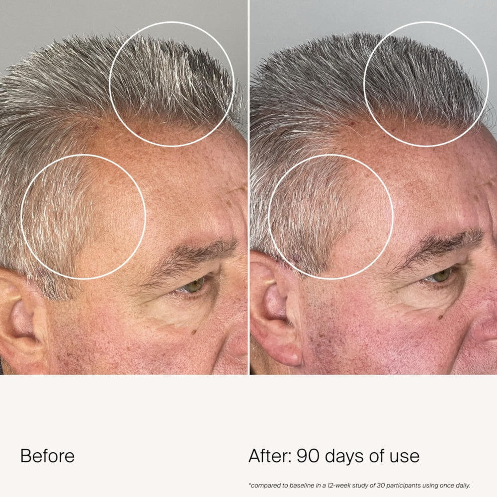 Reduced grey hair visibility with Living Proof Density Serum on the scalp.