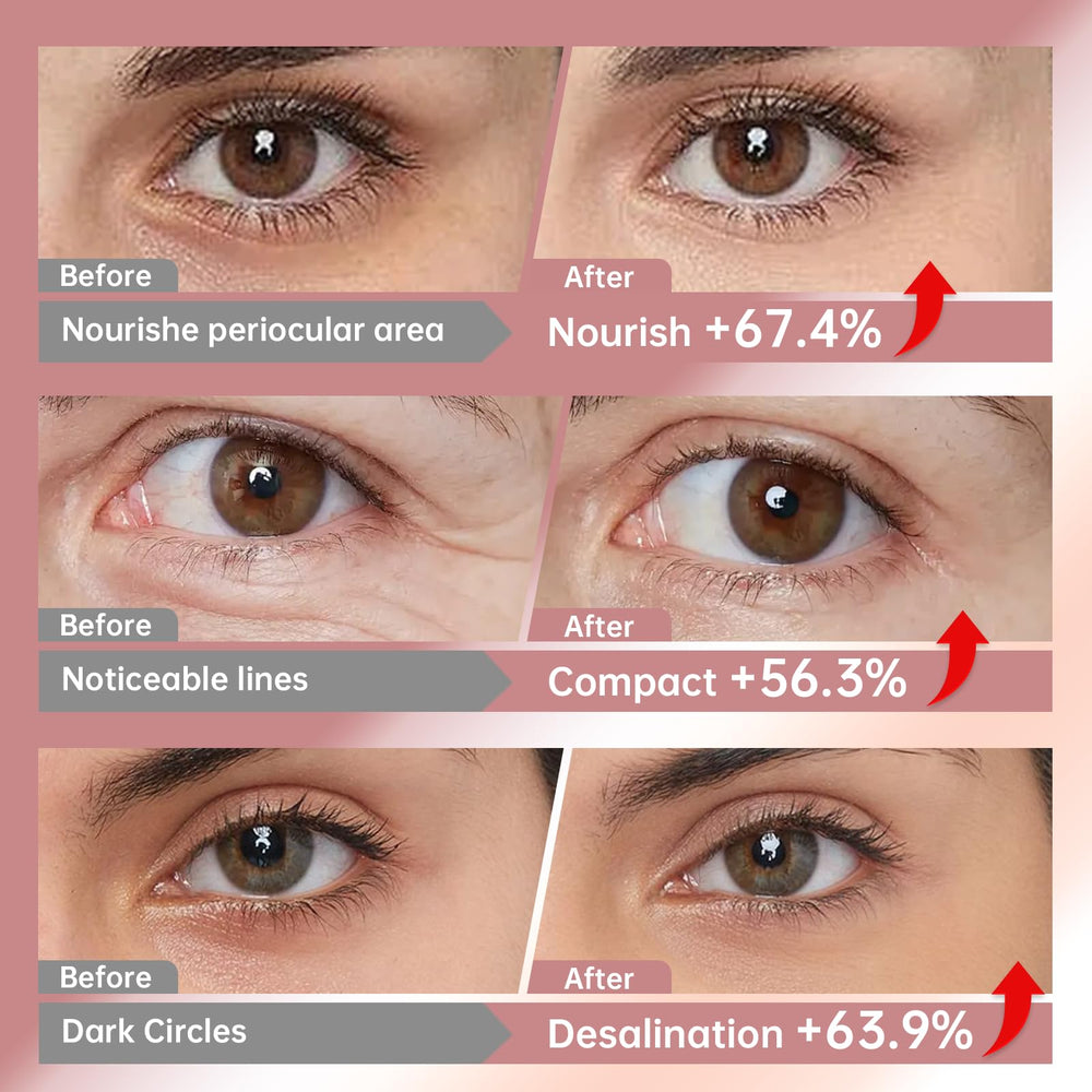 LLVYUO Novoy Rose Eye Patches made in USA with hypoallergenic material