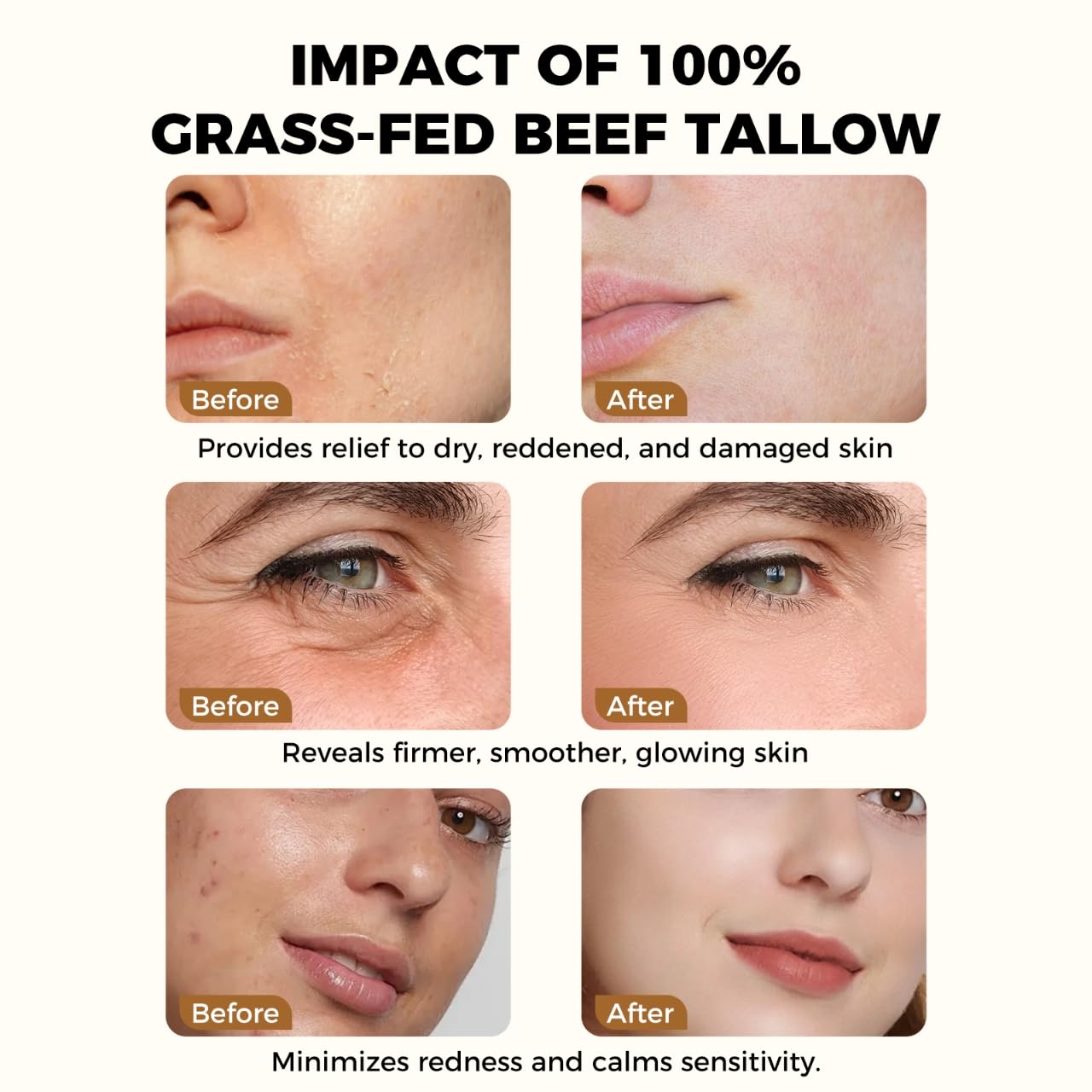 Lopeie sensitive skin formula shown as non irritating care for dry areas