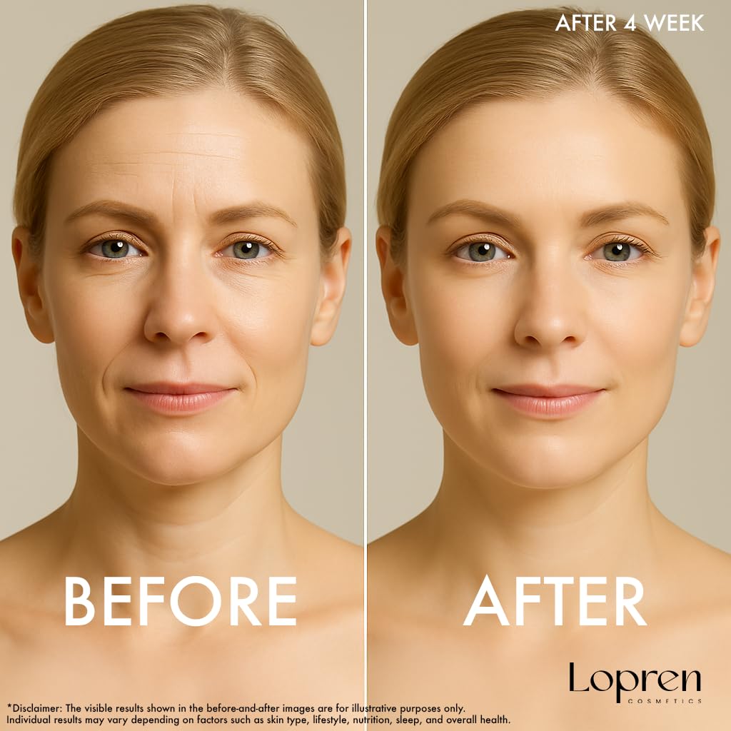 Lopren Hyaluronic Cream texture close-up showing non-greasy finish