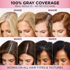 Caring shampoo bottle with Hyaluronic Acid for gentle cleansing and color care