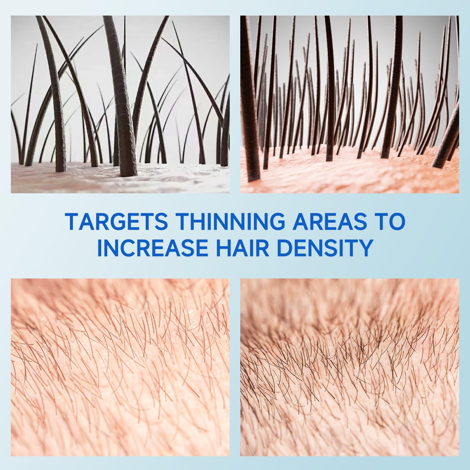 Loreviya dormant follicles support serum visualizing scalp nourishment.