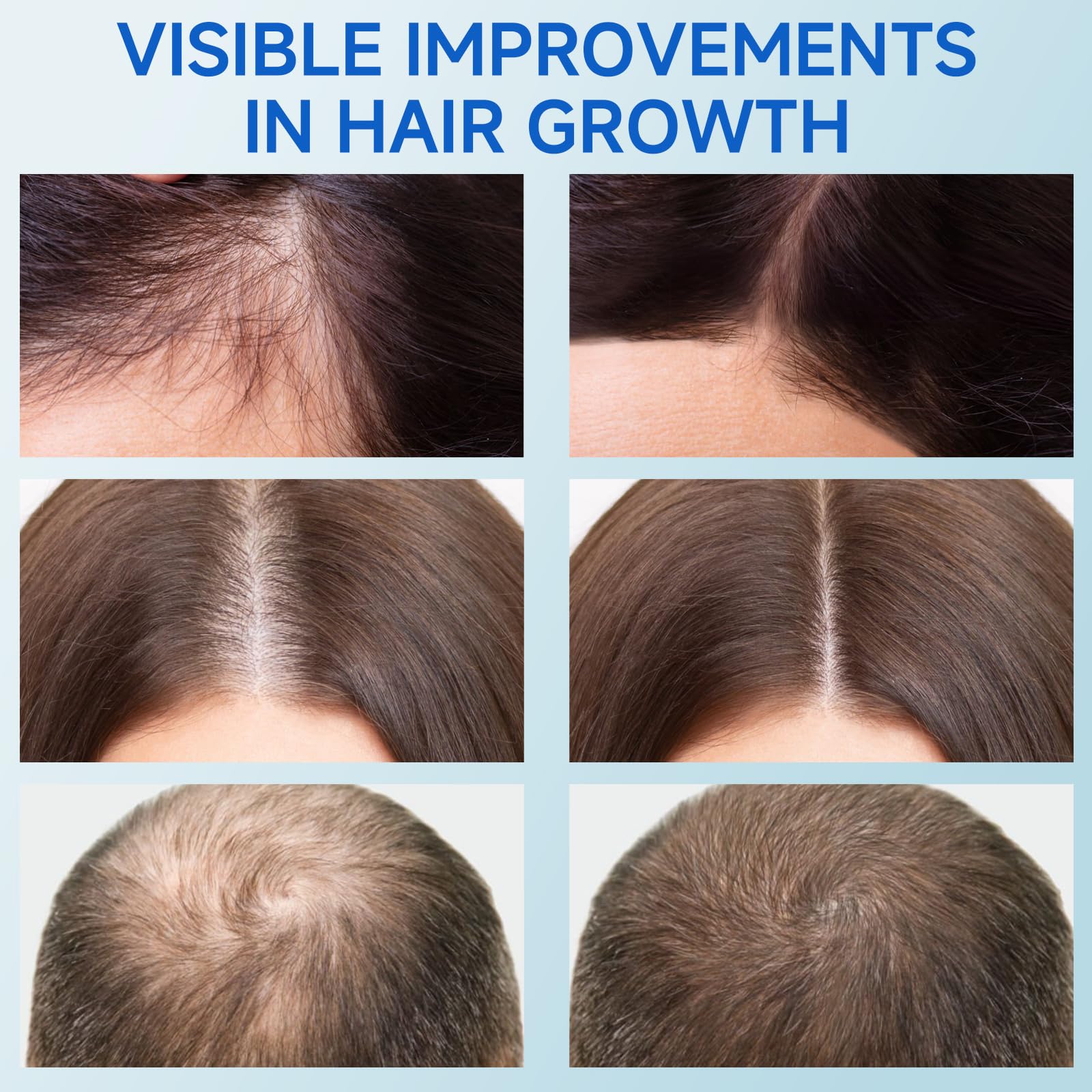 Loreviya precise scalp rollerball applying serum directly to the roots.