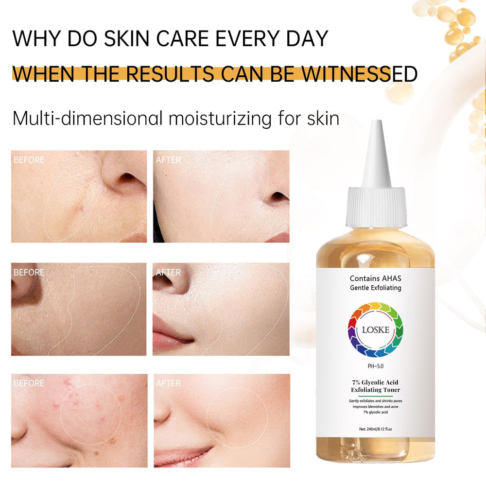 Loske 7% Glycolic Toner with cotton pad application