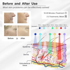 LOUDYKACA LED face mask with 7-color therapy for customizable sessions.