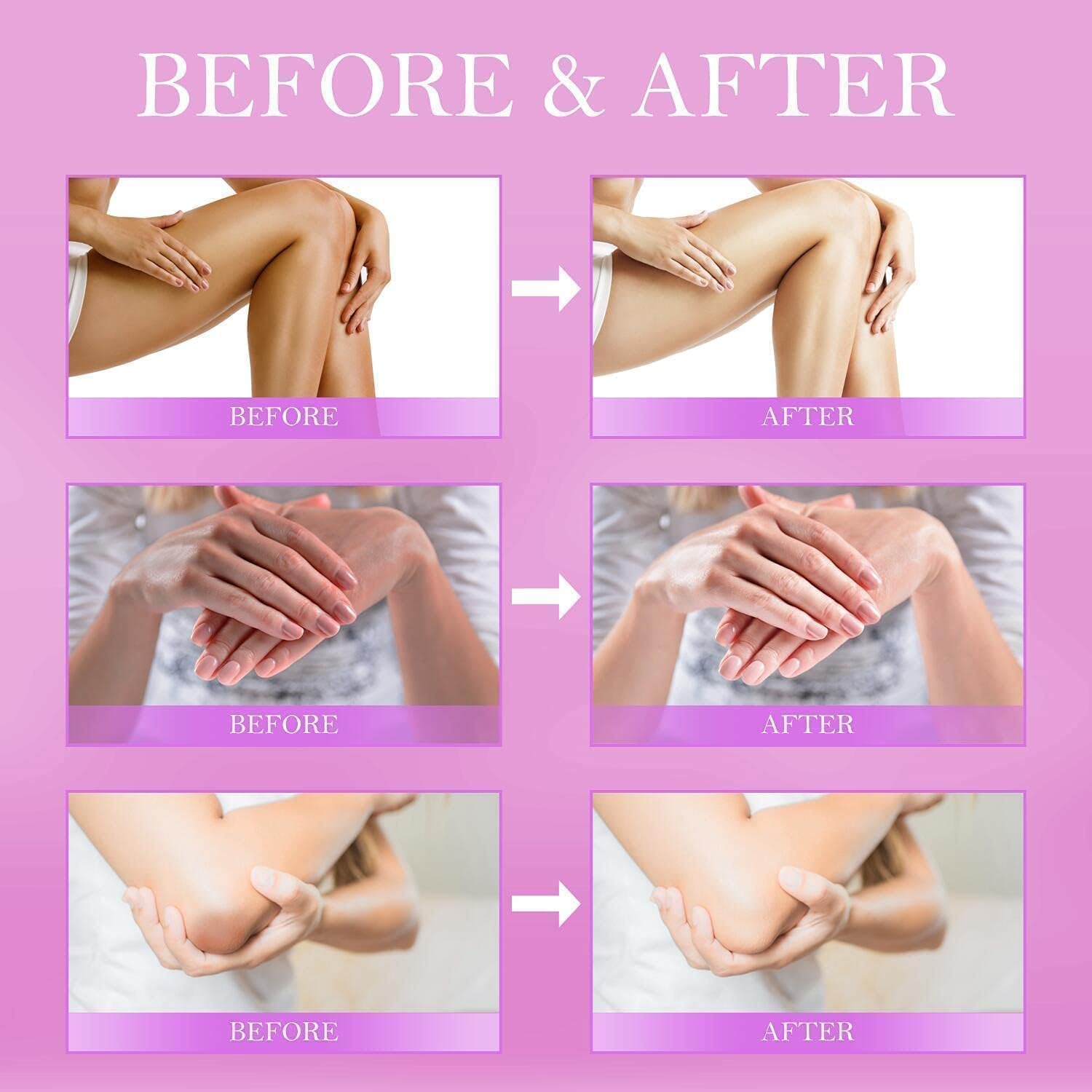 Elbows after LOVOOD for visibly softer skin and even color.
