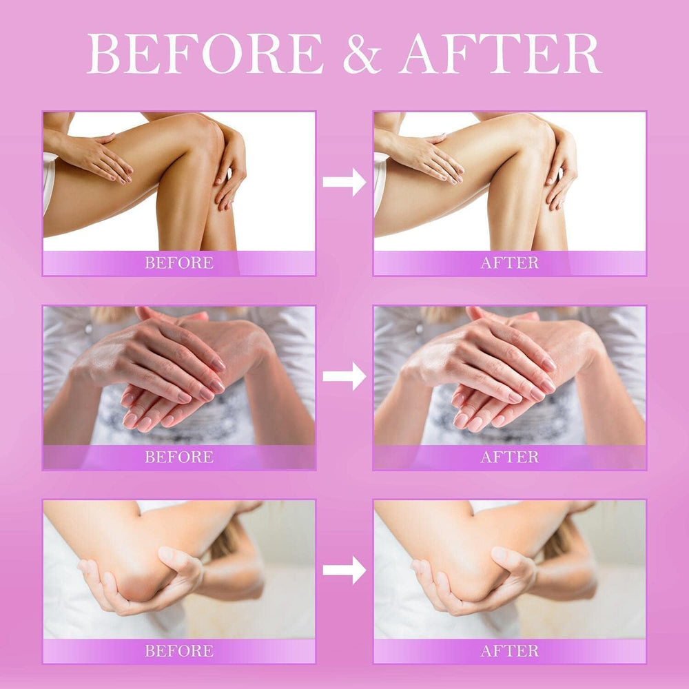 Elbows after LOVOOD for visibly softer skin and even color.
