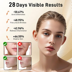 Lovsheme red light mask side view demonstrates ergonomic design for extended sessions.