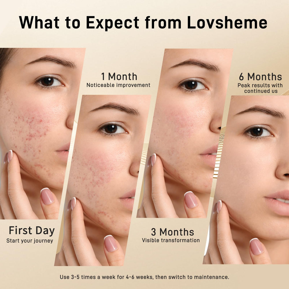 Lovsheme red light mask wavelengths 630, 660, 850 nm for multi-mode therapy.