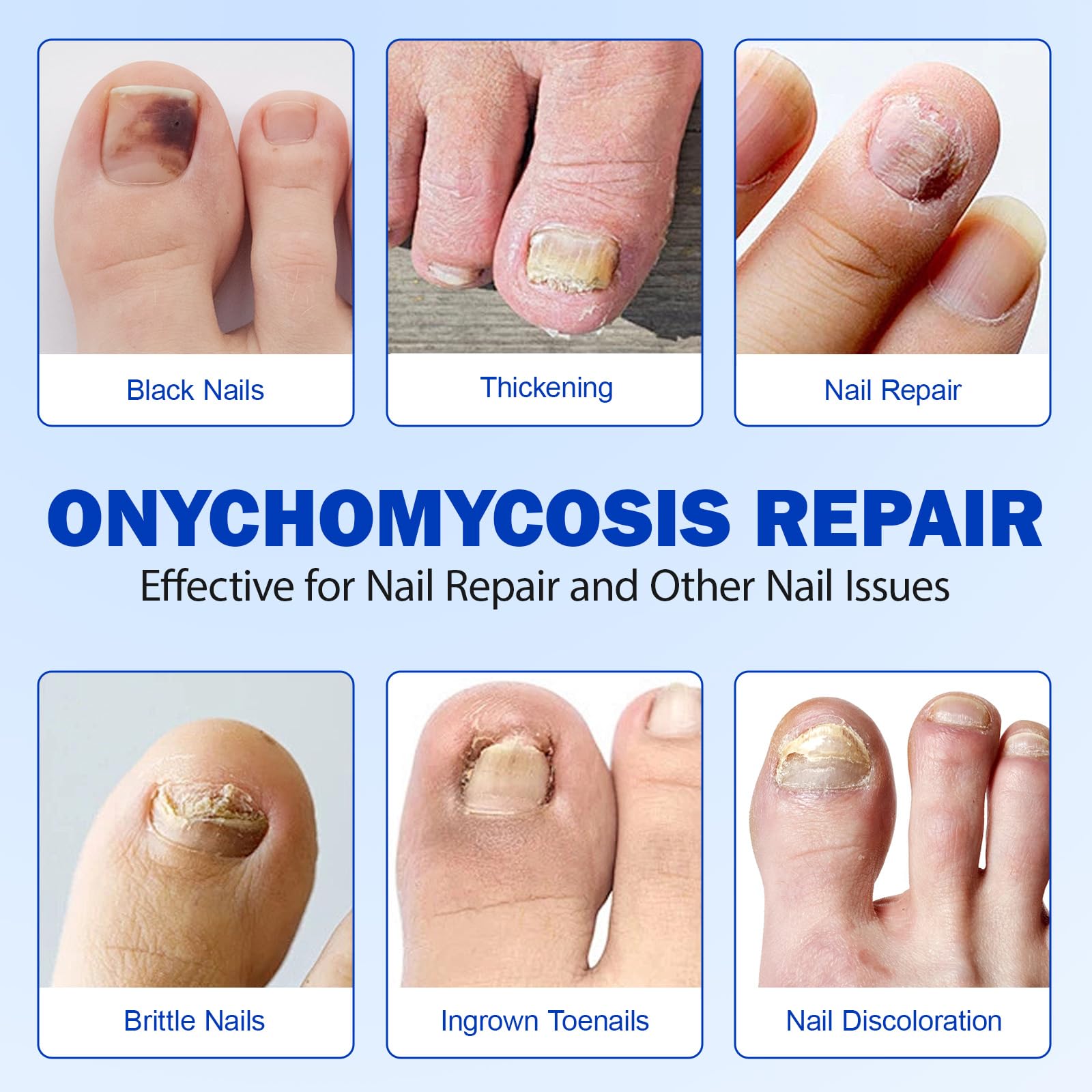 LTQXGT nail repair glue provides strong adhesion for cracks and chips.