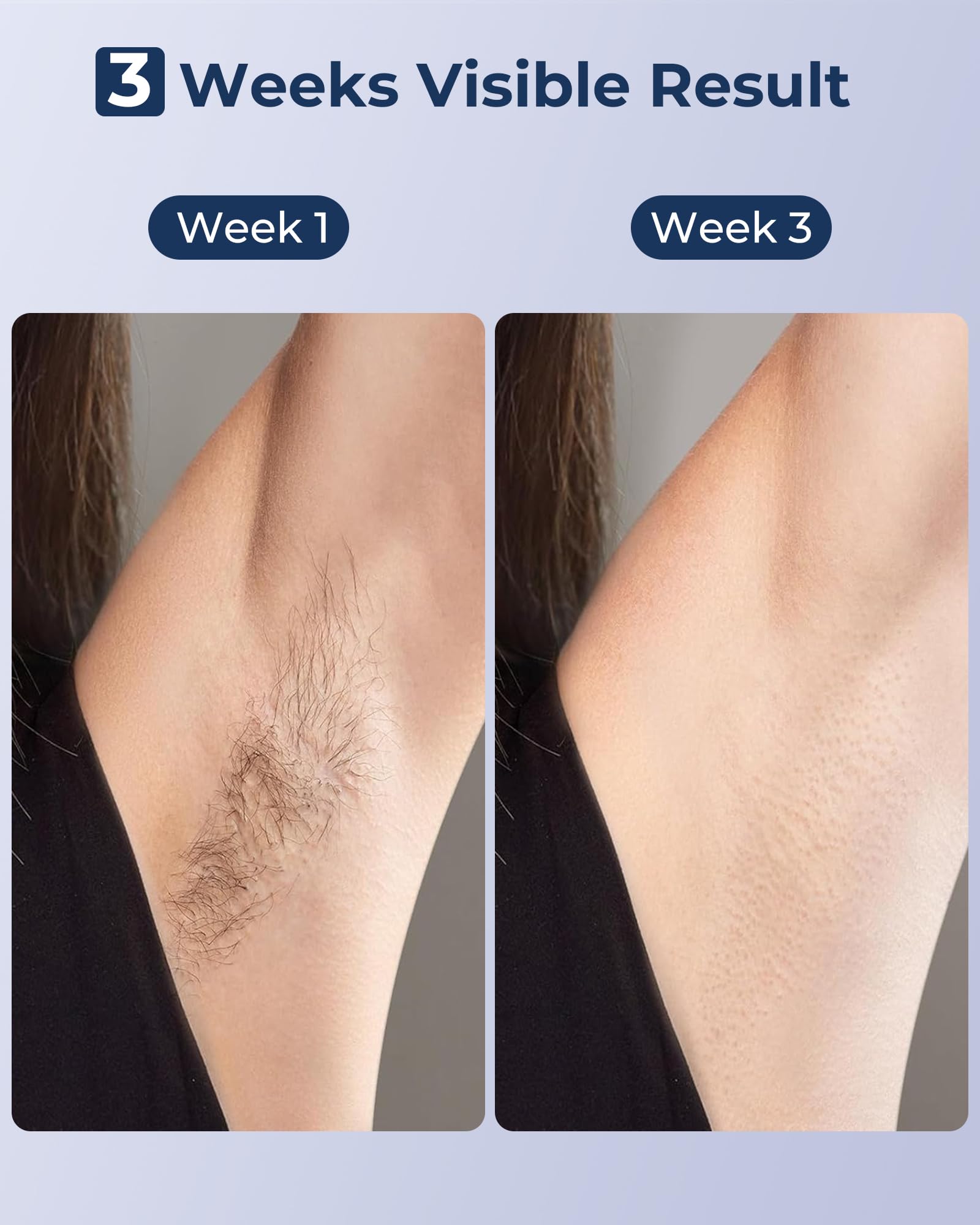 LUBEX IPL face use-case for facial hair reduction
