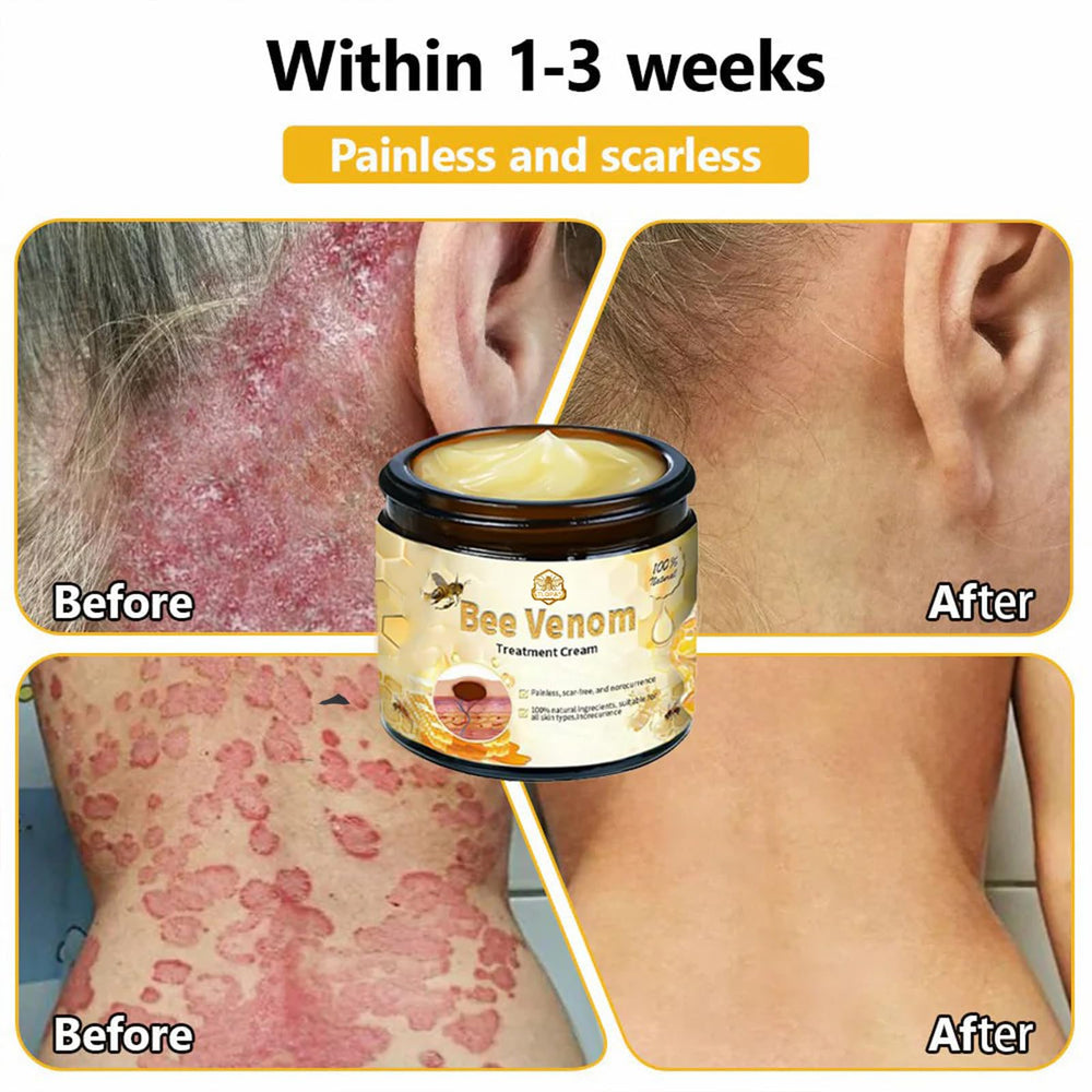 Luhaka Bee Venom Cream packaging highlights premium care for skin.