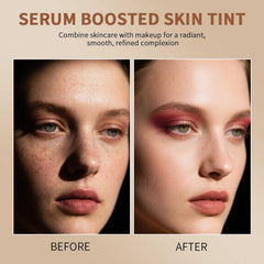 Lulesi Breathable Second Skin Gel-Cream absorbs without clogging pores.