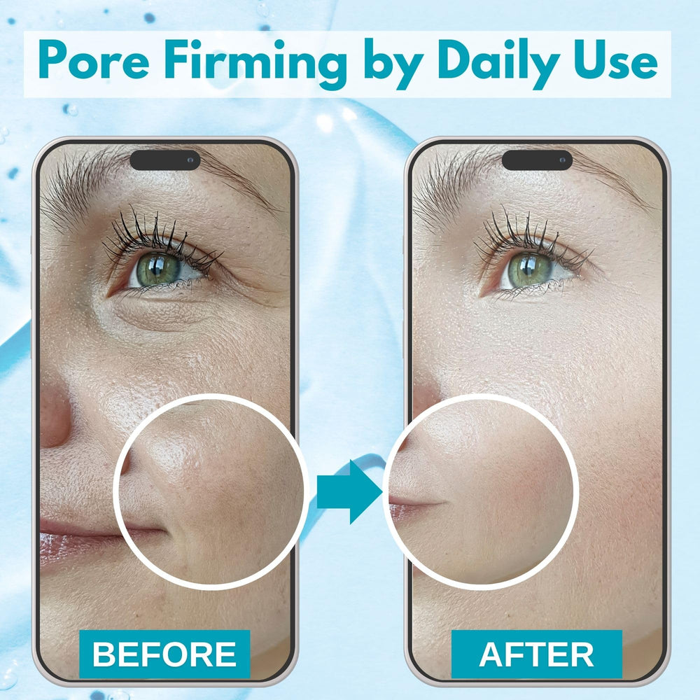 Lululun bifida ferment filtrate mask delivering deep hydration and balanced tone.