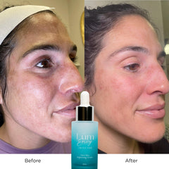 LumEnvy brightening glow image suggesting clearer, more even skin tone.