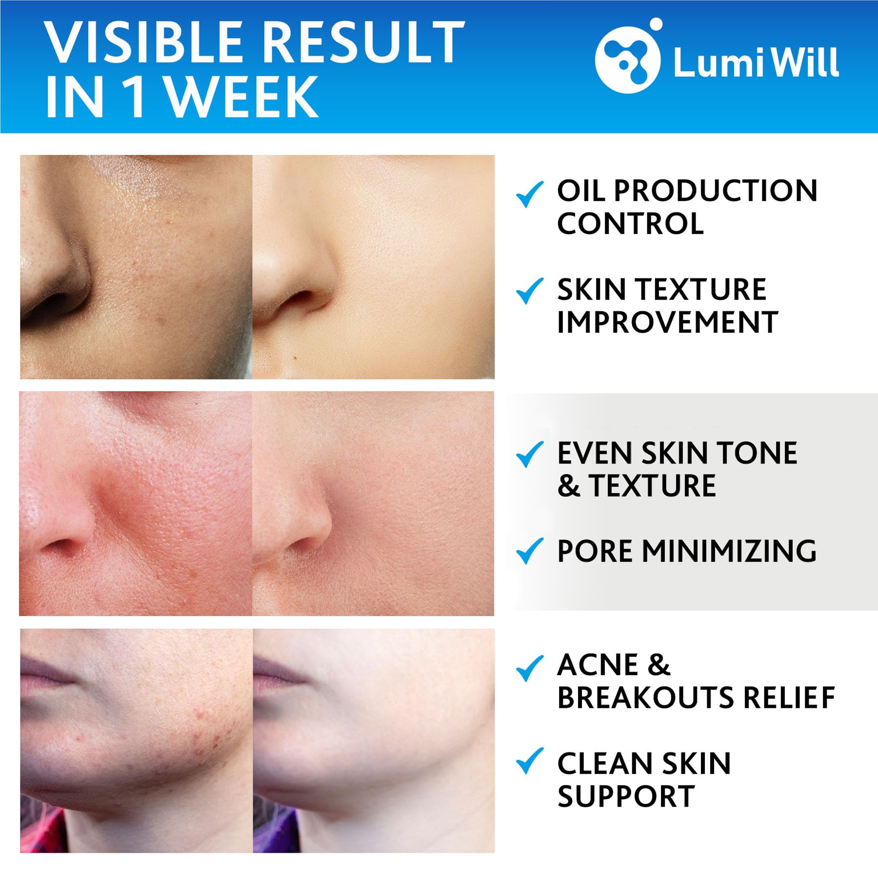 LUMI WILL Glycolic Pads 35% ingredients label highlights vitamins and botanicals