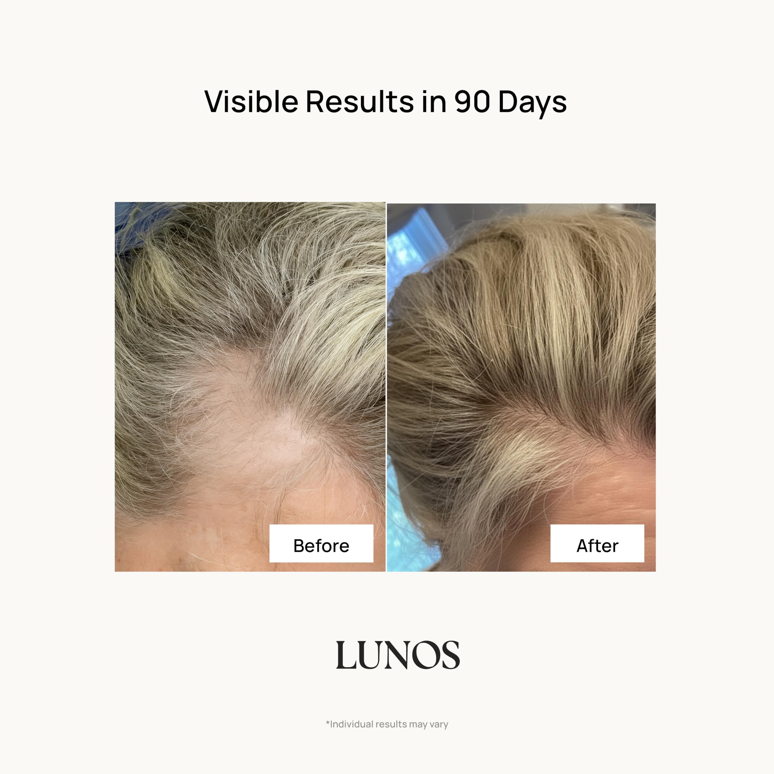 Lunos Grow Hair Growth Vitamins capsules close-up with smooth coating