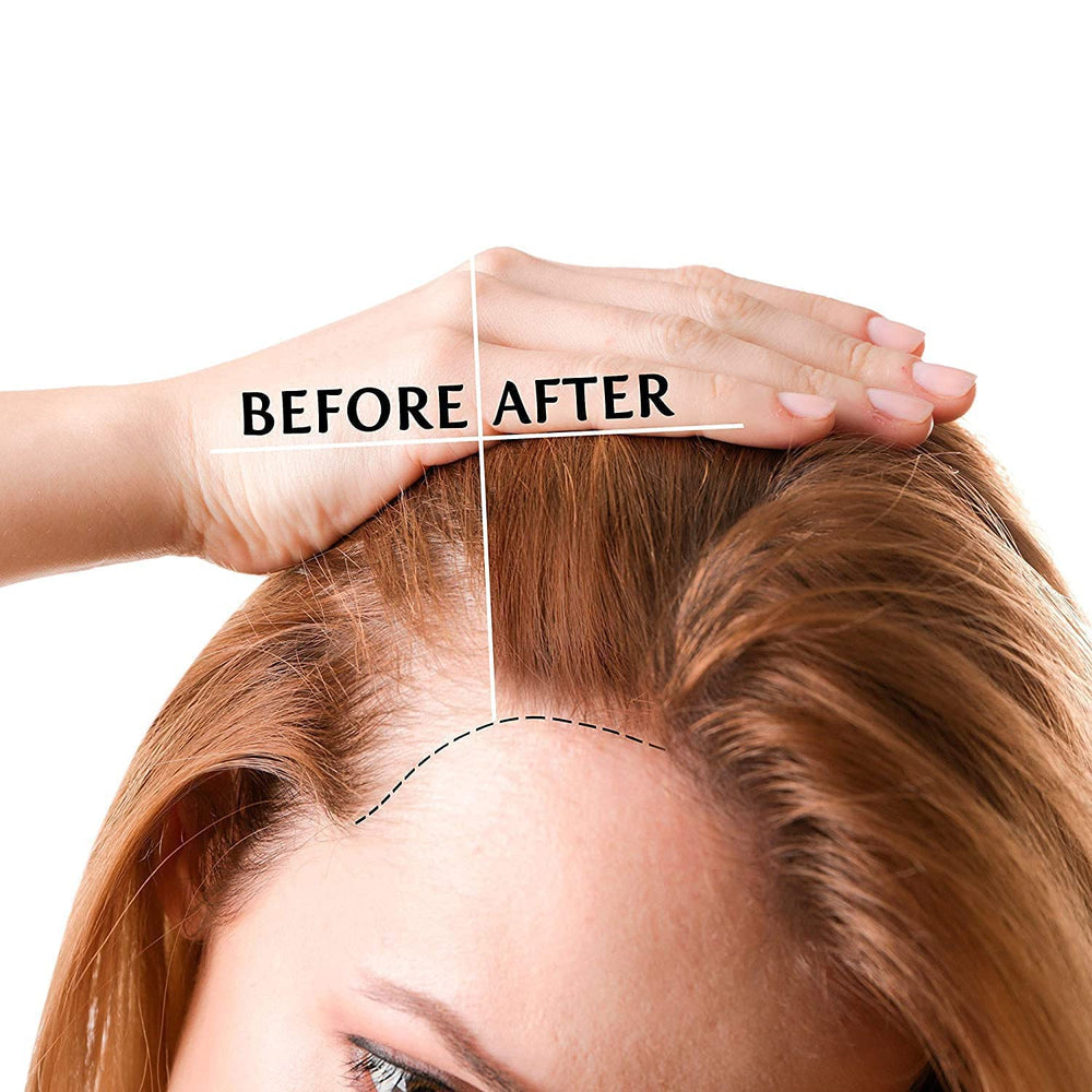 Luv Me Care Biotin Hair Growth Oil dropper ready for precise scalp application