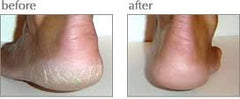 Luxuriant Cracked Heel Repair twin-pack tubes ready for quick, mess-free application.