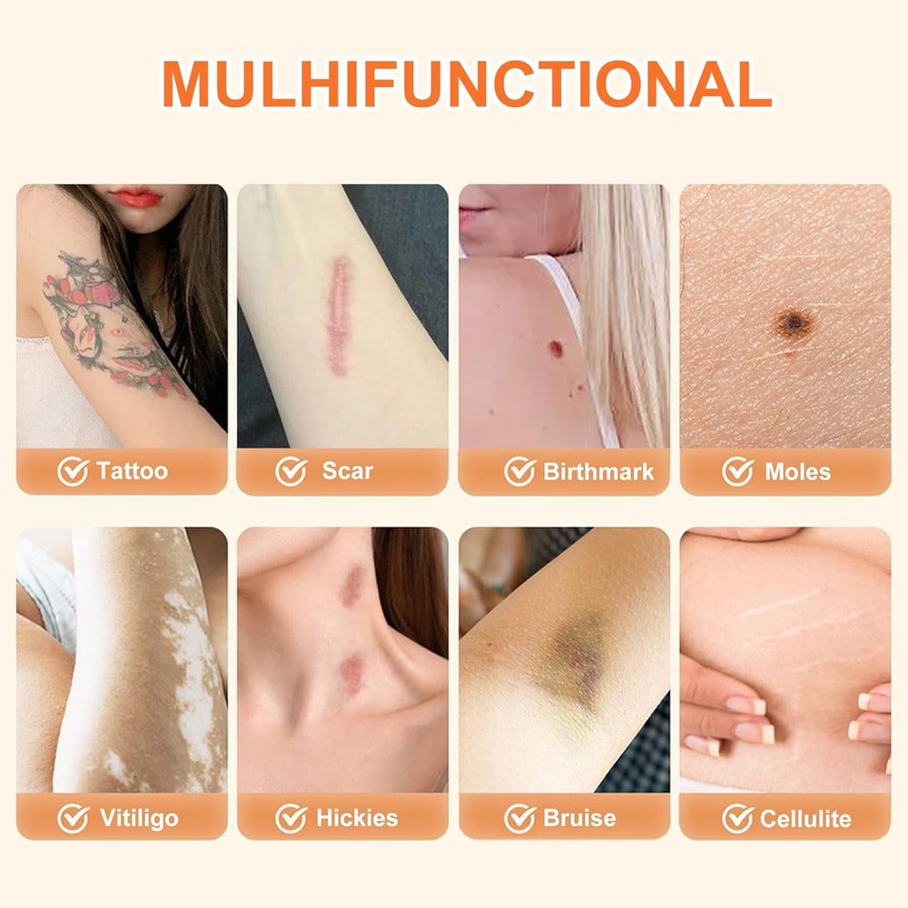 Lvnwrip tattoo cover-up helps conceal scars, birthmarks, and dark spots.