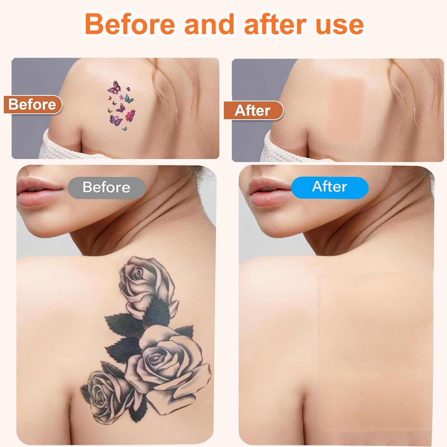 Cuttable design of Lvnwrip patch allows precise coverage shaping.