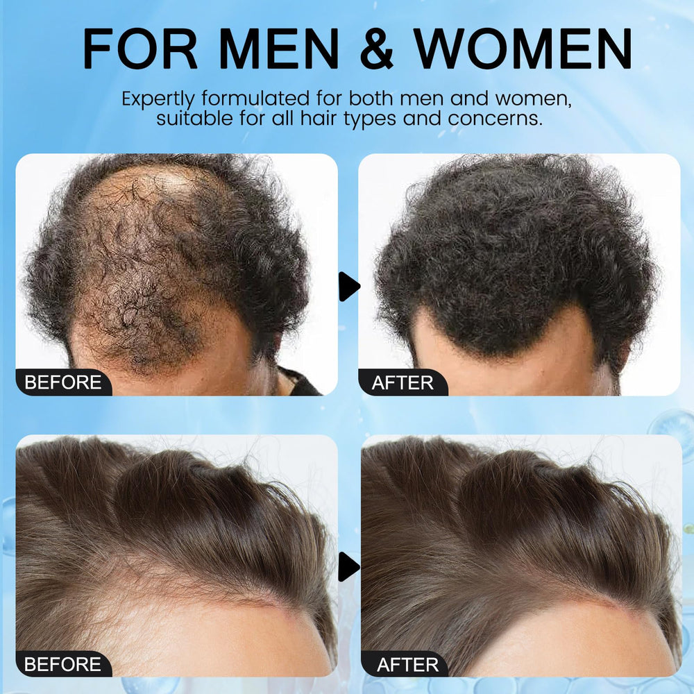 LXMTou Serum on fingertip indicating quick absorption and comfortable scalp care.