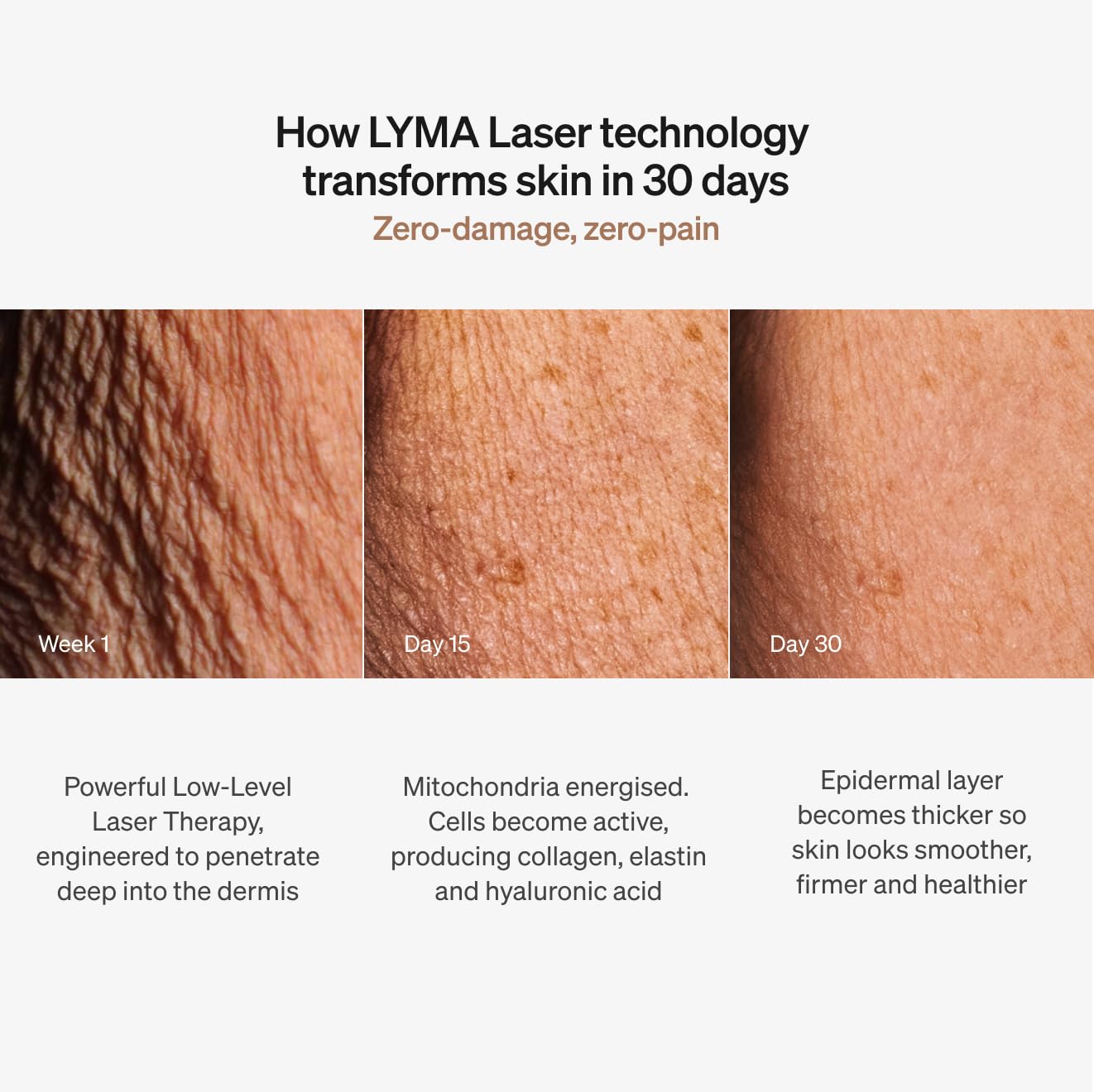 LYMA Laser Device travel-ready case, secure packing for trips.