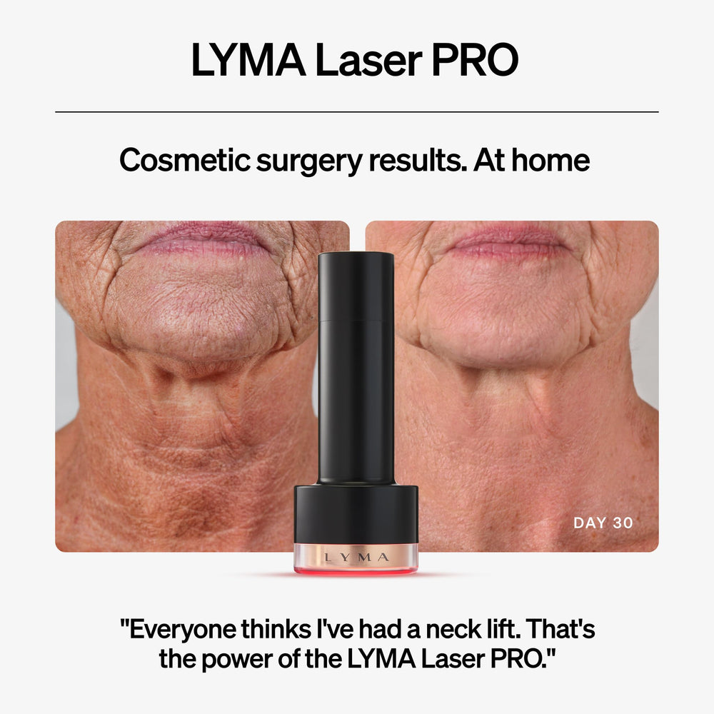 LYMA Laser Pro close-up showing skin texture and radiance improvement.