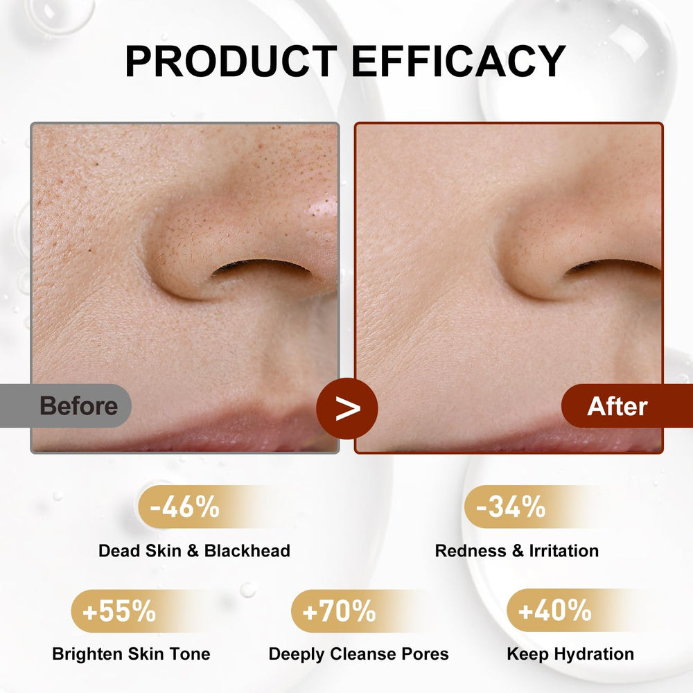 Lynz Pure Peel Shot Glow Niacinamide ampoule close-up, pore refinement benefits.