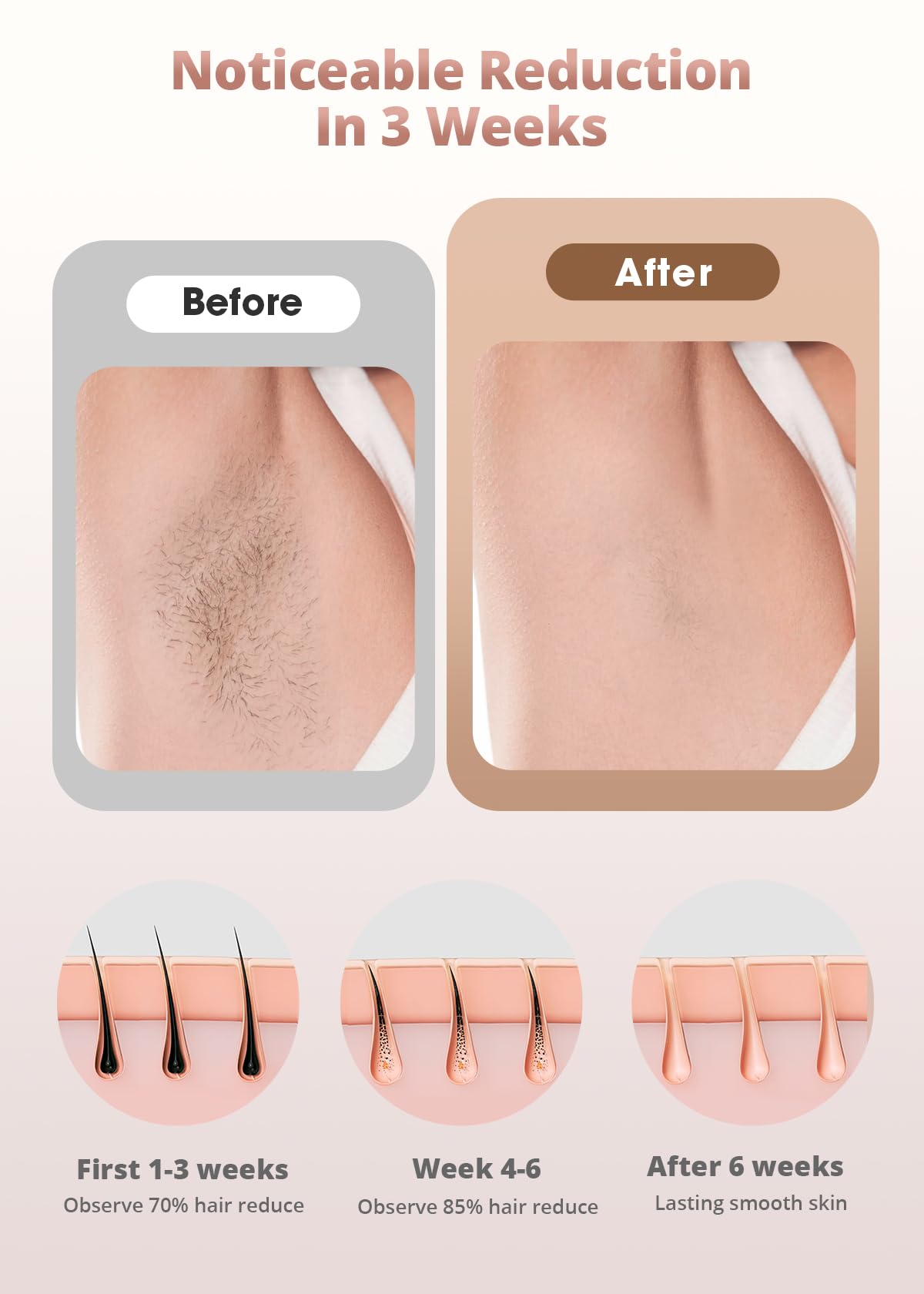 LYSMOSKI face hair removal for delicate areas with safe settings.