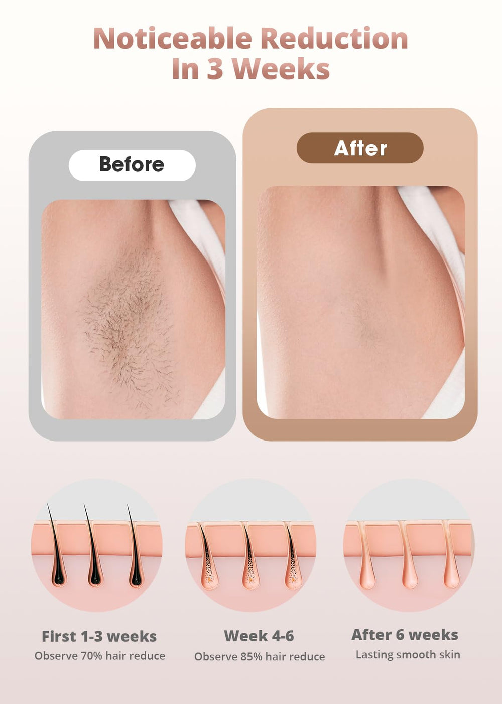 LYSMOSKI face hair removal for delicate areas with safe settings.