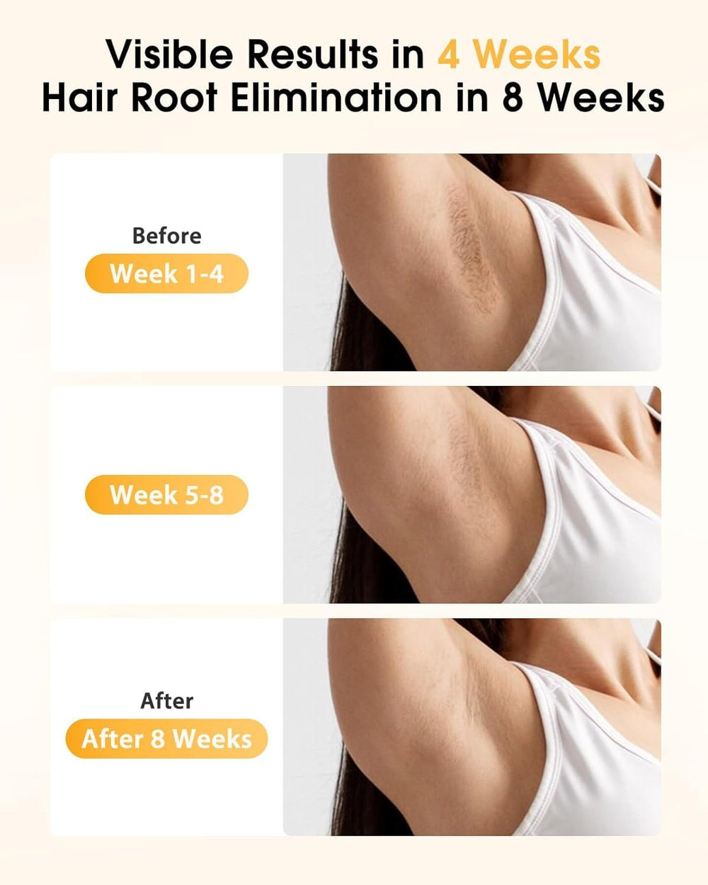 LYSMOSKI IPL device underarms mode delivering gentle, quick hair reduction.