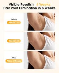 LYSMOSKI IPL device underarms mode delivering gentle, quick hair reduction.