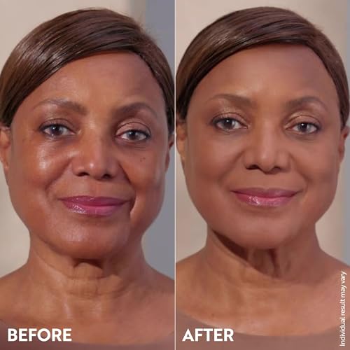 Powder-like finish appears after setting M. Asam mousse on skin