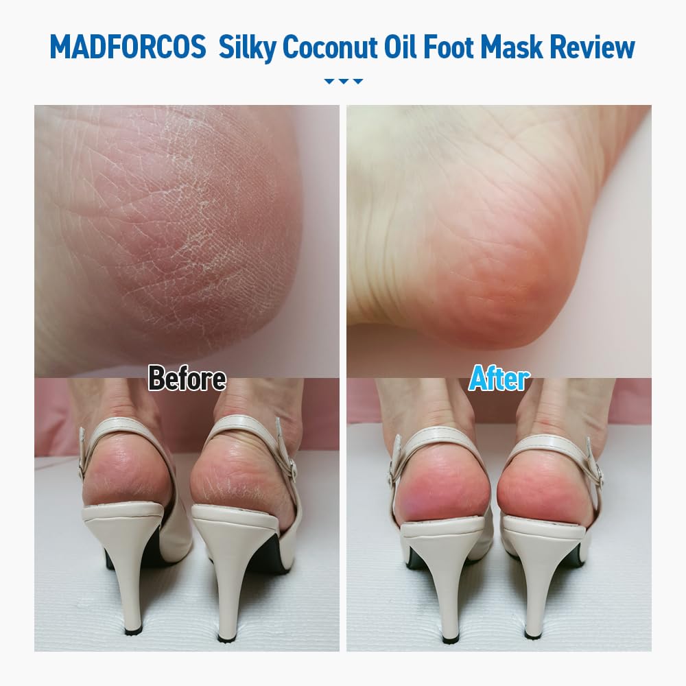 MADFORCOS soft feet after use with smoother appearance